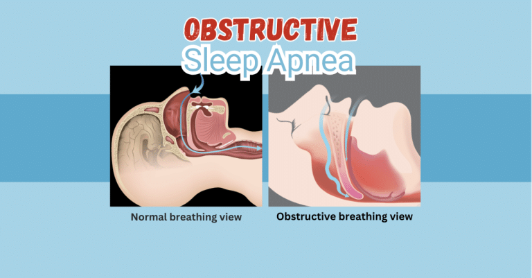 Dental Blog: OSA Obstructive Sleep Apnea and Heart Disease